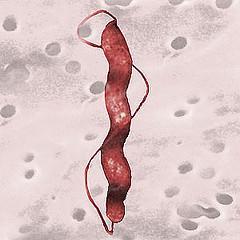 Generalidades - Bacilo curvo, espiral o con forma de S - Gram negativo - Flagelo en uno o ambos extremos - Microaerófilo -