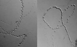 Se recuperó la bacteria TMP2/3 en placas de agar NG. También crecieron en placas de agar L con antibíoticos.