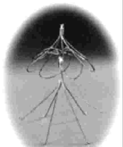 4), fabricado en Nitinol (1991), es de mayor fuerza radial y más liviano, tiene una permeabilidad de VCI a 30 días de 100%. No ferromagnético, se reporta una trombosis del acceso en sólo un 8.