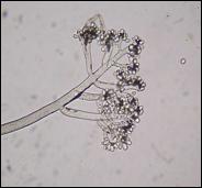 El hongo comúnmente esporula, observándose la presencia de numerosos conidióforos los cuales
