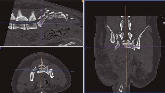 Figura 7 Imagen transversa de tomografía computerizada de un Setter Irlandés de 7 meses remitido tras atropello politrauma.