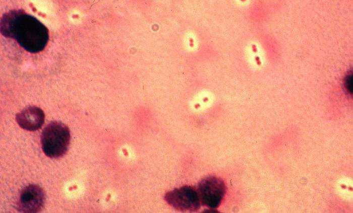 Factores de Virulencia de Streptococcus pneumoniae resistente a la fagocitosis