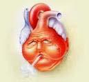 Insuficiencia Cardíaca Síndrome caracterizado por la incapacidad del