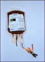 beneficiar a máis dun enfermo xa que os tres compoñentes sanguíneos adoitan utilizarse por separado Tan só 7 de cada 100 doadores posúen o grupo sanguíneo CERO NEGATIVO coñecido