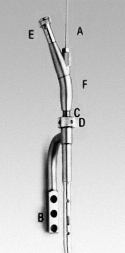 Montaje estándar del instrumental de inserción 1 Deslice el clavo tibial sobre la guía de fresado de 2.5 mm (A). Introduzca a mano el clavo en la cavidad medular lo más profundamente posible.