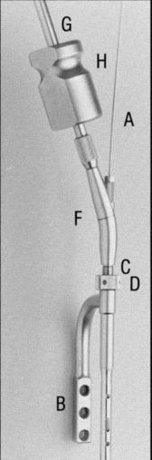 Inserción del clavo (cont.) Montaje alternativo del instrumental de inserción Otra posibilidad es utilizar la guía (G) y el mazo (H) de percusión para insertar el clavo universal para tibia.