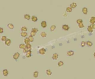semblants als cistidis himenials, agrupats en feixos i acompanyants de cèl lules piriformes, el primers de 51-67 x 12-16 µm, les segones de 23-30 x 10-15 µm Bocairent, rodalies del mas de Maria Bodí,