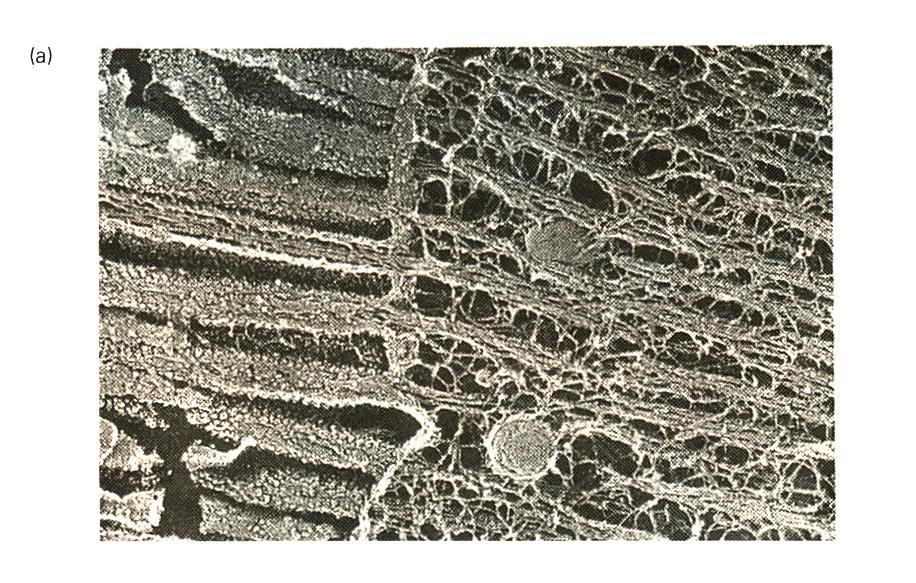 Al unirse a filamentos de actina organizados en manojos, la membrana plasmática