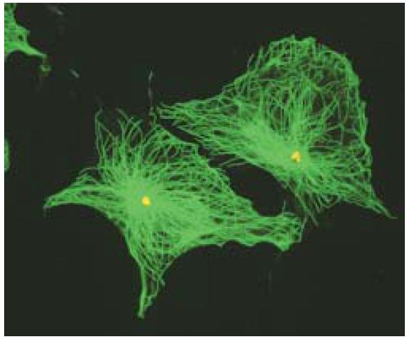 Microtúbulos radian desde Centros Organizadores de Microtúbulos (MTOC), con sus extremos (+) orientados hacia la periferia Micrografía de una célula