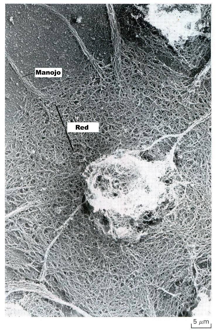 Manojos y redes de filamentos de actina llenan en citosol en una célula Plaqueta tratada con detergentes a fin de permeabilizar su
