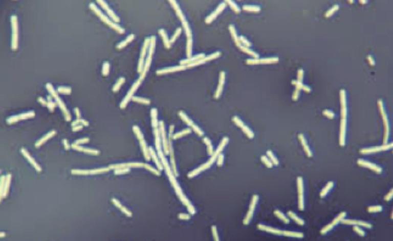 Tinción negativa Objetivo Introducir un método rápido para observar microorganismos que no pueden ser teñidos con los colorantes usuales. Fig.