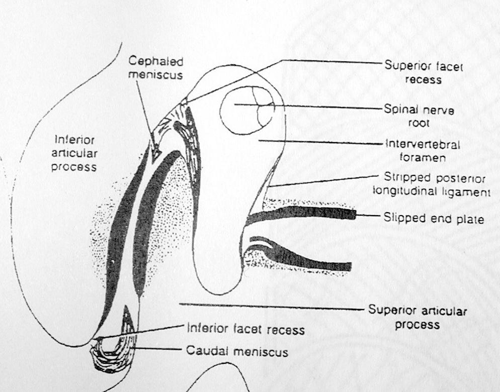 Membrana Sinovial Presenta repliegues sinoviales internos, tambien llamados inclusiones meniscoídeas.