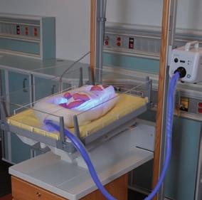 Luz curativa en el lugar necesario BiliSoft ofrece fototerapia en cualquier lugar: en la UCI neonatal, pediatría,