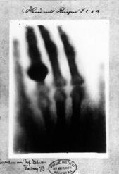 libres, los que confiamos en la grandeza luminosa del futuro. 60 Fig.5.Retrato futurista de Marinetti. Tato Veronesi, 1913. Fig.7 (a y b). Rayos X de la mano de Berta Röntgen, diciembre de 1895.