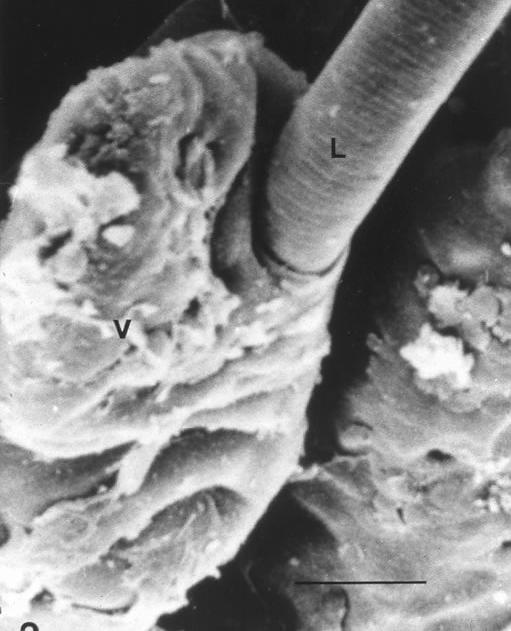 mucosa intestinal (larva L1) Diferenciación de estadios