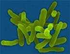Exotoxinas Naturaleza química: proteínas letales toxoide afectan células específicas del hospedador Pueden viajar de una parte
