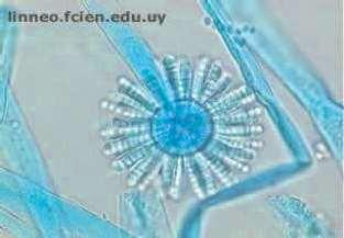 Mananoproteinas Retículo endoplasmático Aparato de Golgi