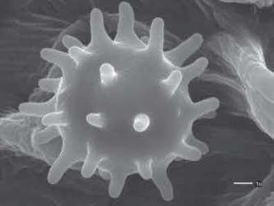 La Meiosis ocurre en la zygospora Glomeromycota Producen