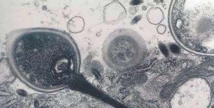 , 2008) Espora con tubo polar insertado en célula eucariota. La espora inyecta su protoplasma.