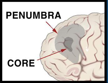 PENUMBRA ISQUEMICA: FISIOPATOLOGIA DE LA VENTANA TERAPEUTICA Penumbra Core CEREBRAL BLOOD FLOW 20 Normal function (ml/100g/min) 15 10 PENUMBRA Neuronal dysfunction CBF 8-18 5 CORE Neuronal death CBF