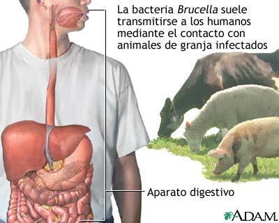 Brucelosis Producida por una bacteria ( Brucella) Hay 4 tipos Melitensis ( cabras y ovejas) Abortus (vacas) Suis ( cerdos) Canis ( perros) Se trasmite por el contacto a través