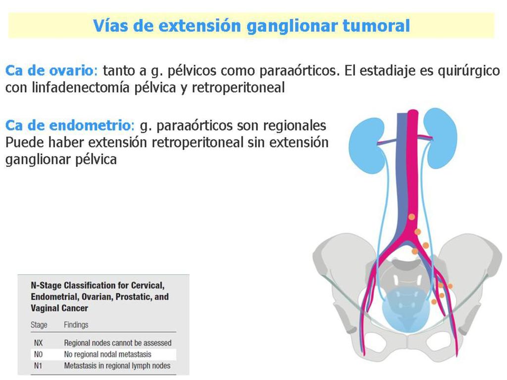 Fig. 17: Carcinoma de ovario