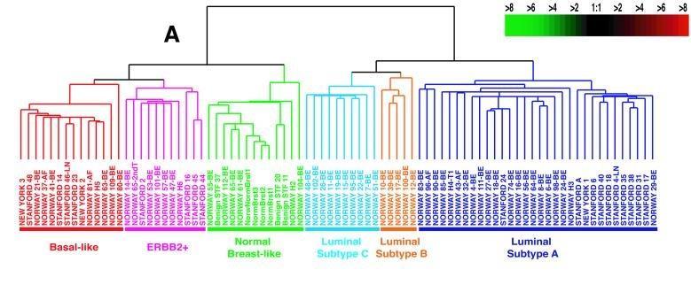 A) RE(-) RE(+) B) Figura 1: Agrupamiento jerárquico de los tumores de cáncer de mama en 6 subtipos diferentes.
