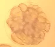 4 Embrión 8