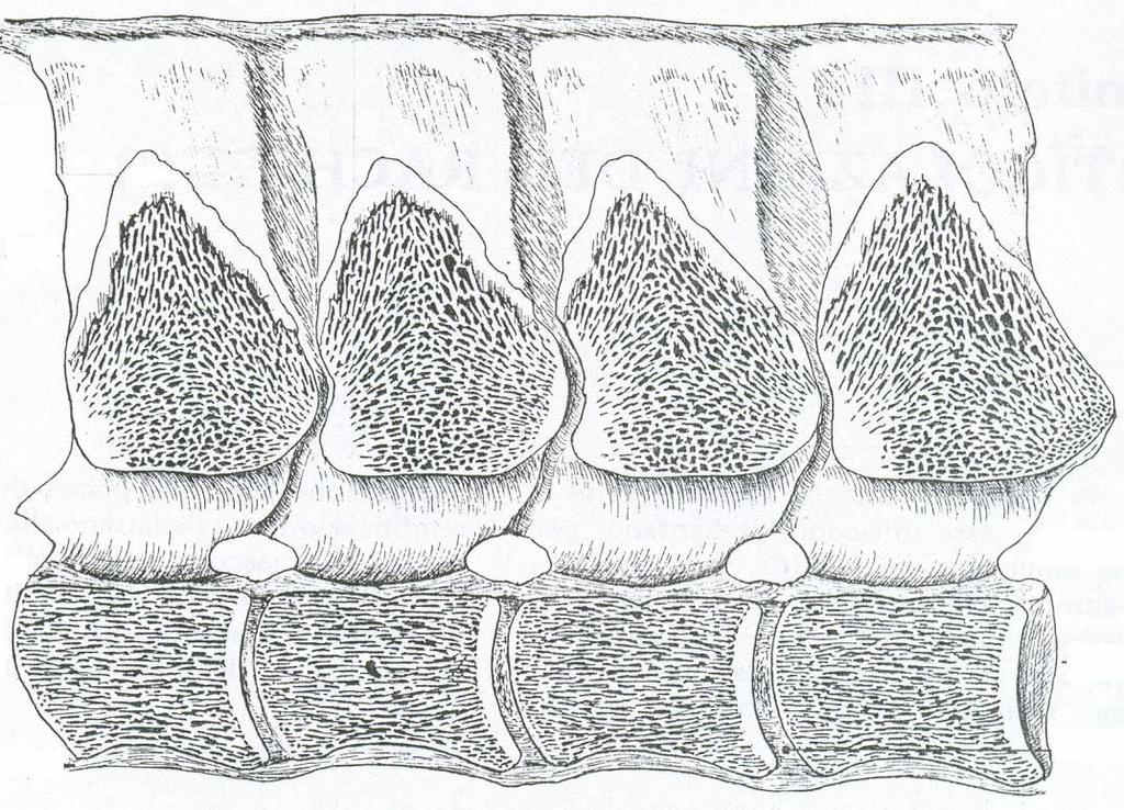 b) Ligamento amarillo Membrana que une a las dos láminas vertebrales