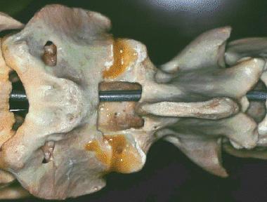 2.- Articulaciones vertebrales