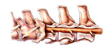 1.- Articulaciones vertebrales comunes 1.a.-Articulaciones de las vértebras por el cuerpo 1.