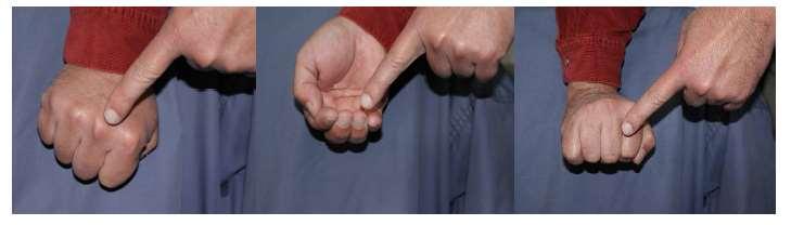 de los nudillos de la mano como se indica en la imagen A de la Figura 9; una condición corporal 3, se siente similar a cuando se pasa por la punta de los dedos (imagen B de la Figura 9) y una
