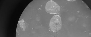 Medición del diámetro de los ovocitos bajo microscopio estereoscópico Caracterización macroscópica del ovario.