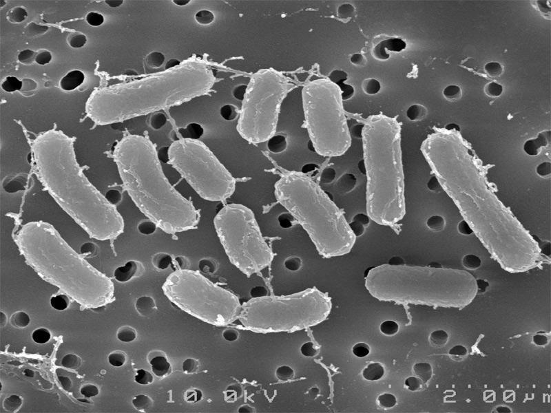 ameba Bacterias del