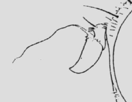 1 Ápice del tercer segmento antenal terminado en punta (Figura 9); parte distal del aculeus con margen aserrado.