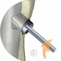 2. Para implantes Gamma: coloque la aguja de Kirschner en el tornillo cefálico.