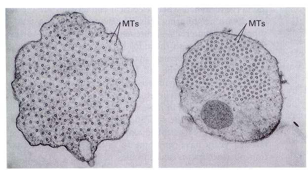 estabilización y espaciamiento en fascículos MAP2 y tau son proteínas