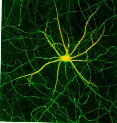 En neuronas MAP2 se localiza principalmente en dendritas y Tau en axones
