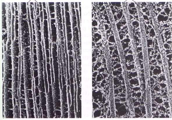 Observe el diferente espaciamiento de los microtúbulos.