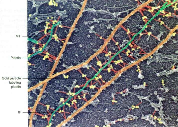 Los filamentos intermedios se asocian con microtúbulos
