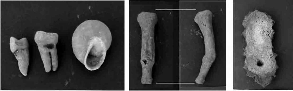 - UNIDAD 14 Contexto funerario 1: se recuperó los restos óseos correspondientes a por lo menos 15 individuos (8 niños bebes y 7 adultos) de diferente sexo: - 75 fragmentos de cráneo, 15 mandíbulas, 8