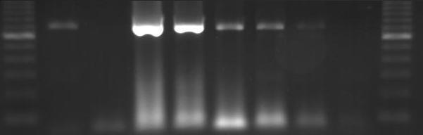 Comparte características con el OsHV-1 y el OsHV µ Var Cuatro o más variedades Mexicanas de OsHV-1 M 1 2 3 4 5 6 7 8 M 600 pb 100 pb Detection of Oyster herpesvirus (OsHV) using PCR: M) 100bp DNA