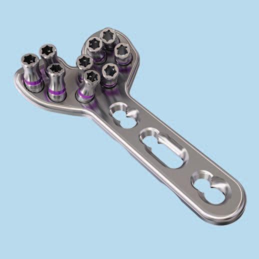 Implantación 4c Introducción de tornillos distales con guías de broca LCP cortas Instrumentos 03.110.006 Medidor de profundidad para aguja de Kirschner de 1.8 mm, longitud 150 mm 02.110.300 Aguja de Kirschner de 1.