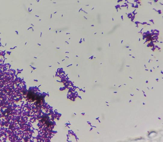 , Proteus spp., Salmonella spp., Shigella spp., Yersinia spp., Pseudomonas spp.
