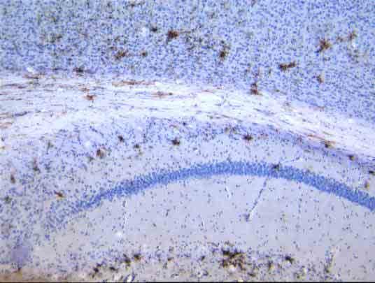 Microglia activada, cerebro de ratón
