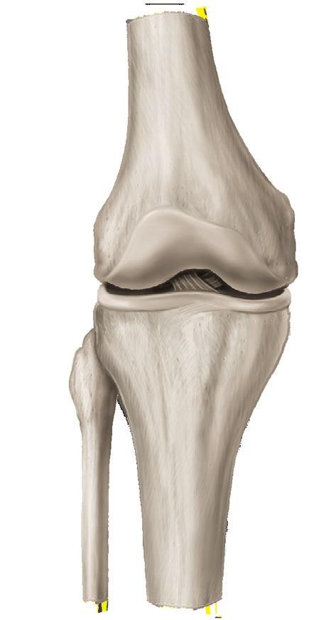 La osteoartritis, la forma más común de artritis, es una enfermedad que causa el desgaste del cartílago de la articulación.