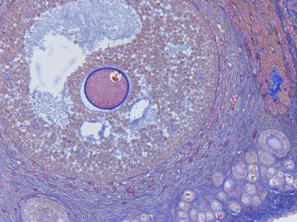 III. Identifica en este folículo sus componentes celulares. Corte de ovario de gata con tinción tricrómica de Mallory.