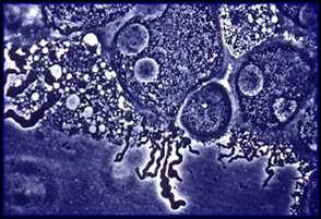 detección de antígenos o anticuerpos, o cuando se inyectan moléculas fluorescentes en células para utilizarlas como marcadores.