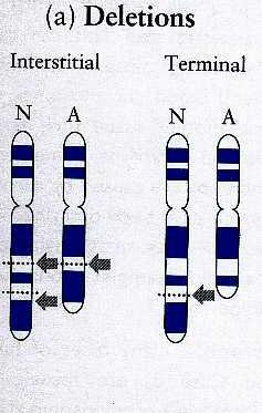 cromosoma 5. Incidencia. 1/50.