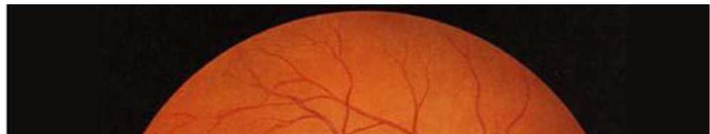 En esta imagen puede observarse la retina humana, el área más coloreada situada en el centro es la